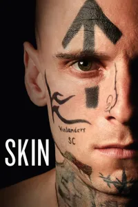 Skin izle